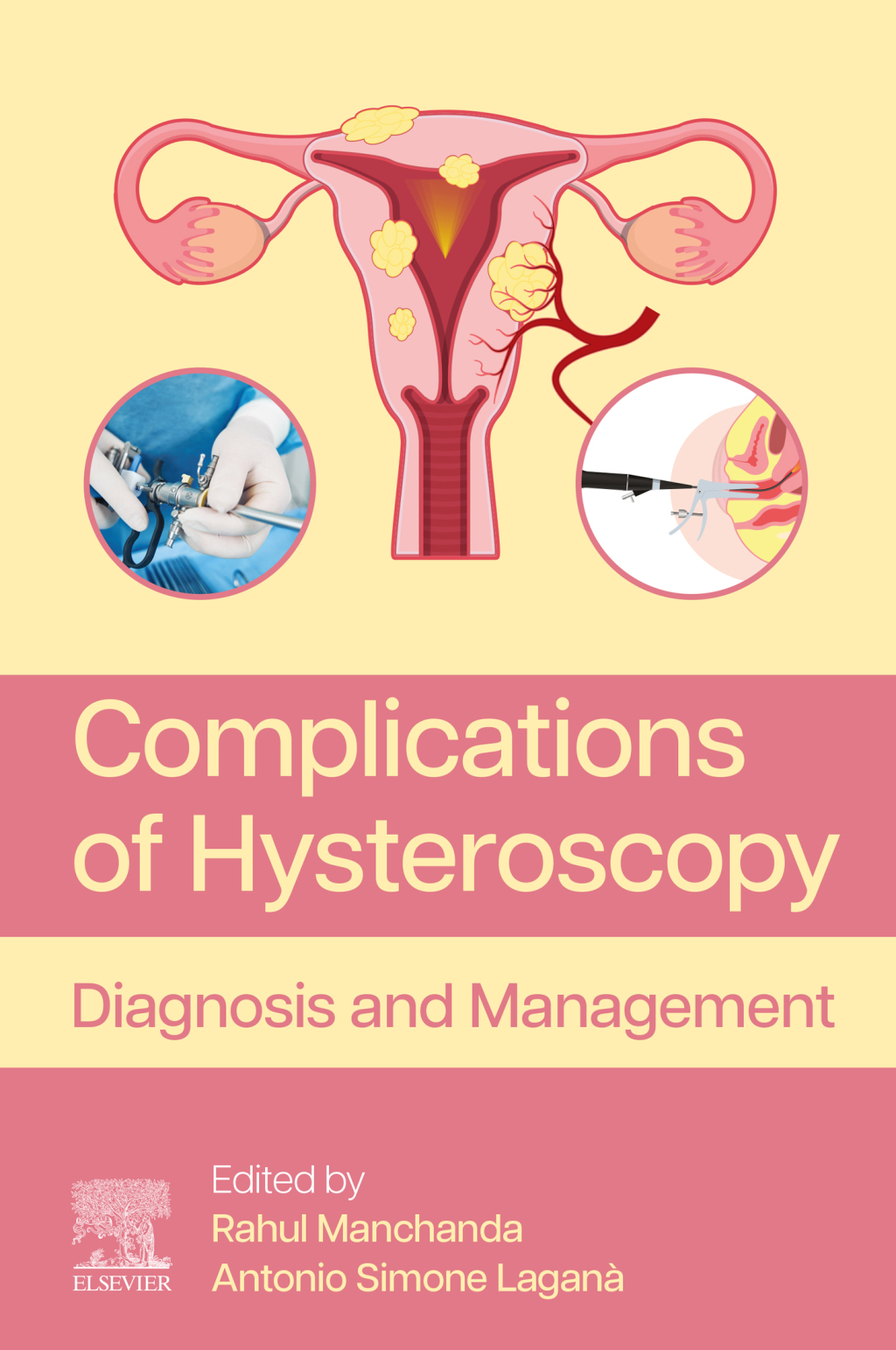 Complications of Hysteroscopy Diagnosis and Management 1st Edition