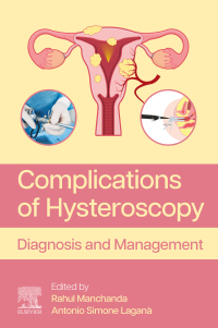 Immagine di copertina: Complications of Hysteroscopy 1st edition 9780443216169