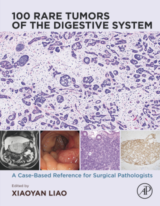 Cover image: 100 Rare Tumors of the Digestive System 9780443220616