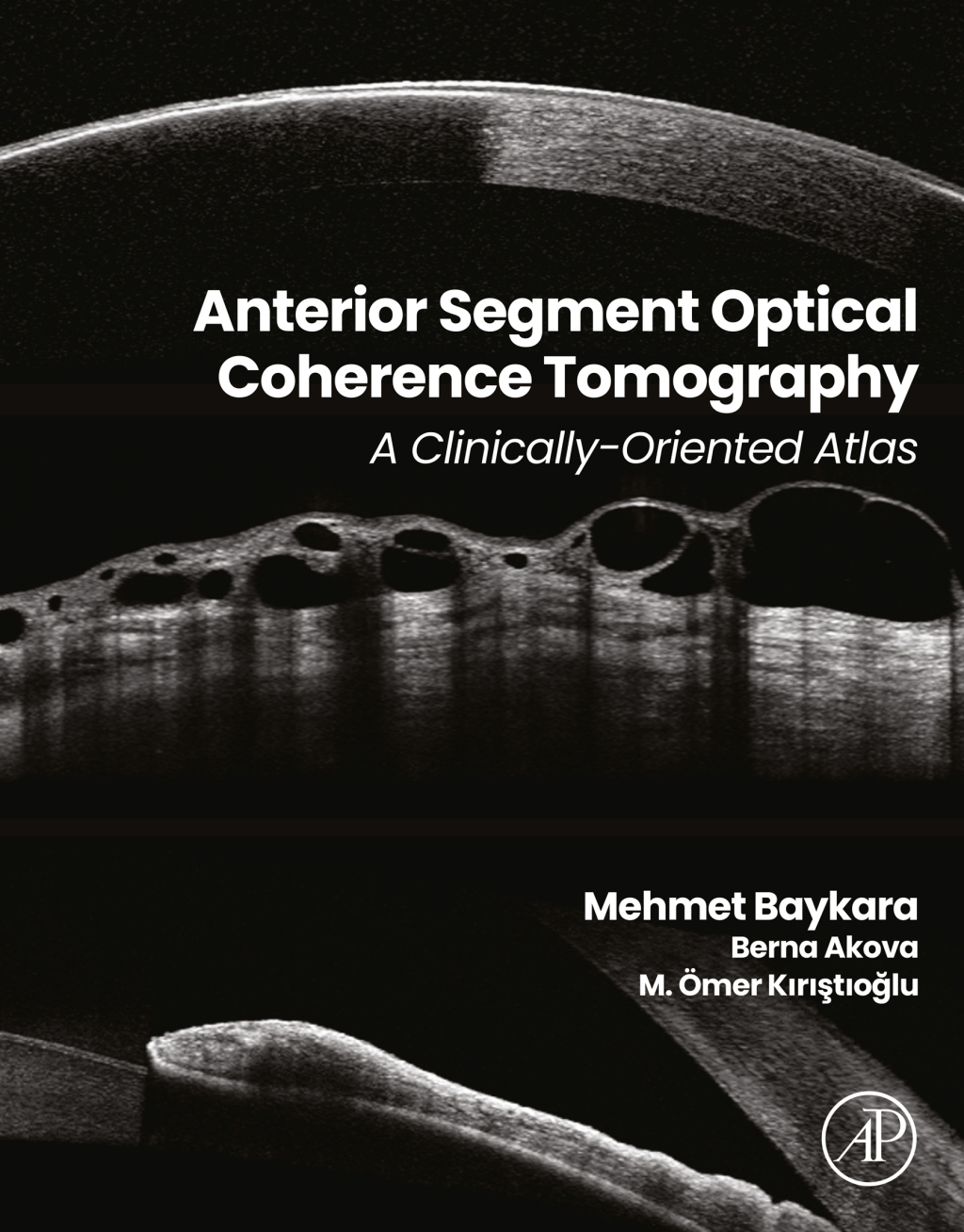 Anterior Segment Optical Coherence Tomography A Clinically-Oriented Atlas