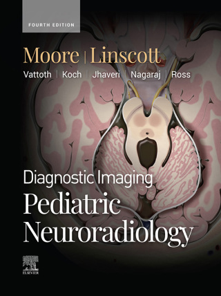 Immagine di copertina: Diagnostic Imaging: Pediatric Neuroradiology 4th edition 9780443234927
