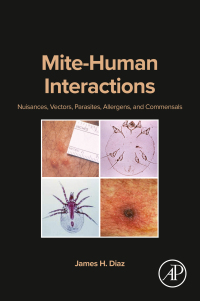 Omslagafbeelding: Mite-Human Interactions 1st edition 9780443235245