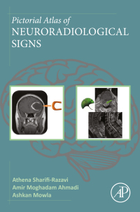 Titelbild: Pictorial Atlas of Neuroradiological Signs 1st edition 9780443235283