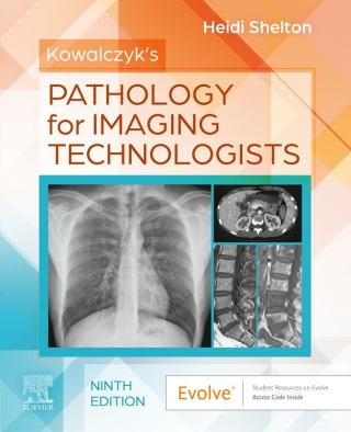 Immagine di copertina: Kowalczyk's Pathology for Imaging Technologists 9th edition 9780443224300