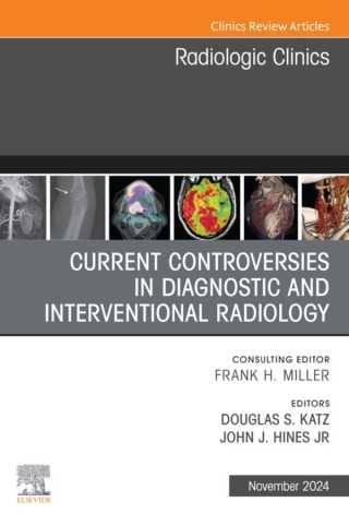 Immagine di copertina: Current Controversies in Diagnostic and Interventional Radiology, An Issue of Radiologic Clinics of North America 1st edition 9780443246265