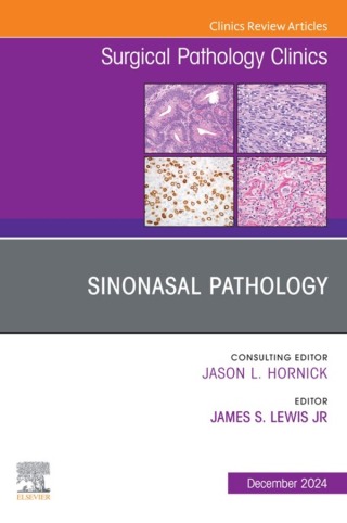Immagine di copertina: Sinonasal Pathology, An Issue of Surgical Pathology Clinics 9780443246685