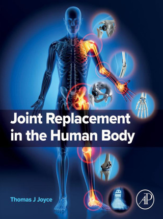 表紙画像: Joint Replacement in the Human Body 1st edition 9780443248689