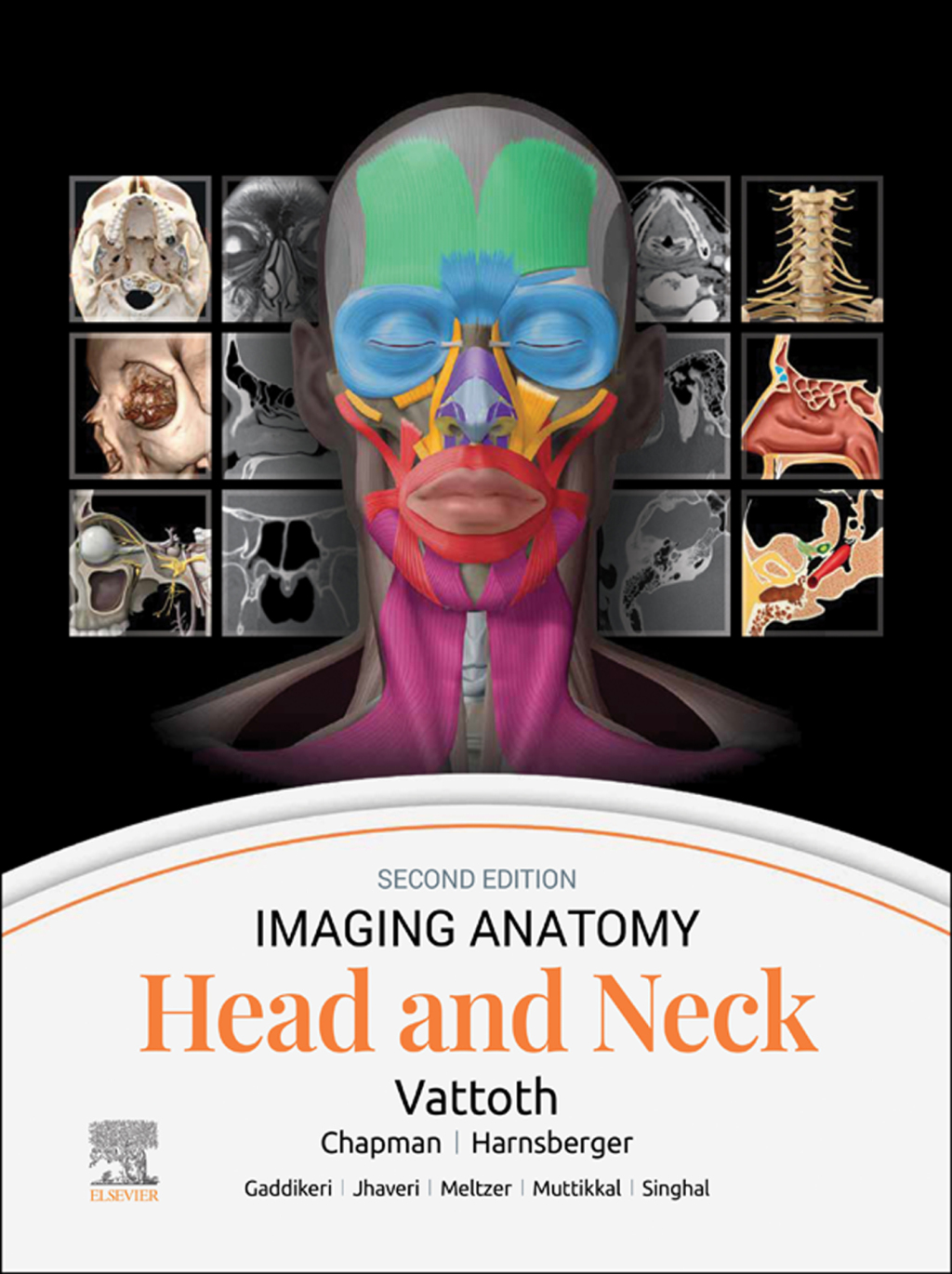 Imaging Anatomy: Head and Neck 2nd Edition