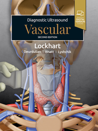 Immagine di copertina: Diagnostic Ultrasound: Vascular 2nd edition 9780443283666