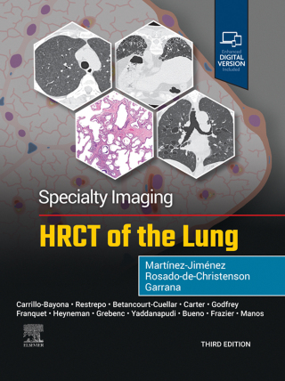 Cover image: Specialty Imaging: HRCT of the Lung 3rd edition 9780443286360