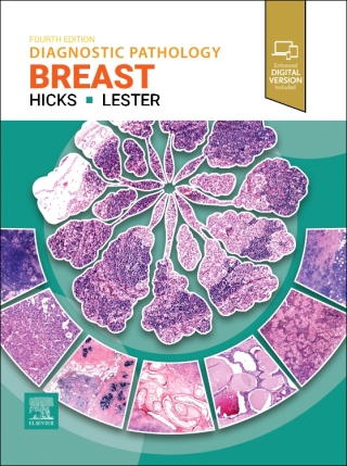 Cover image: Diagnostic Pathology: Breast - EBook 4th edition 9780443286810