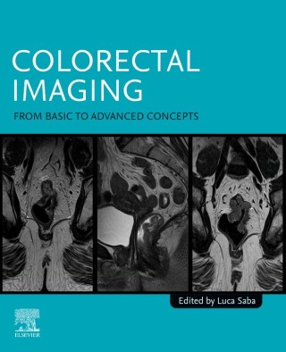 Cover image: Colorectal Imaging 9780443290480