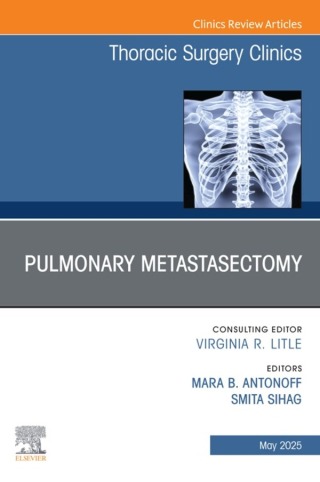 Immagine di copertina: Pulmonary Metastasectomy, An Issue of Thoracic Surgery Clinics 9780443294761