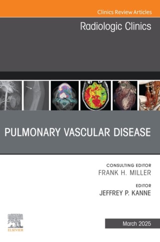 Cover image: Pulmonary Vascular Disease, An Issue of Radiologic Clinics of North America 9780443294822
