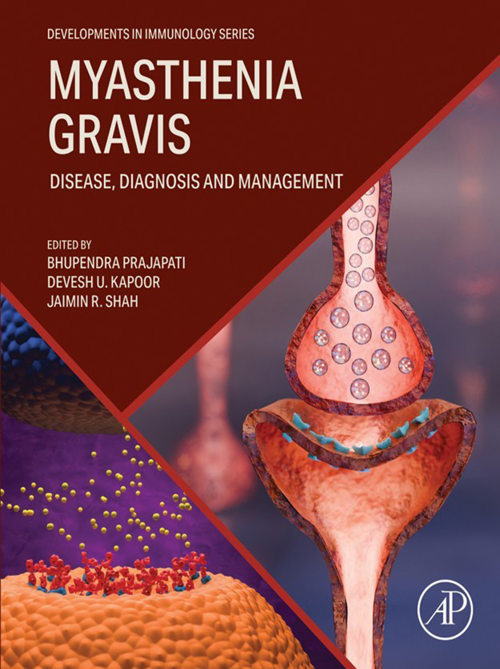 Myasthenia Gravis eBook