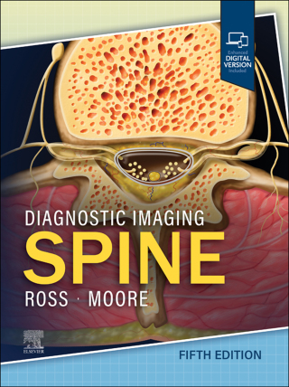 Cover image: Diagnostic Imaging: Spine - E-Book 5th edition 9780443378812