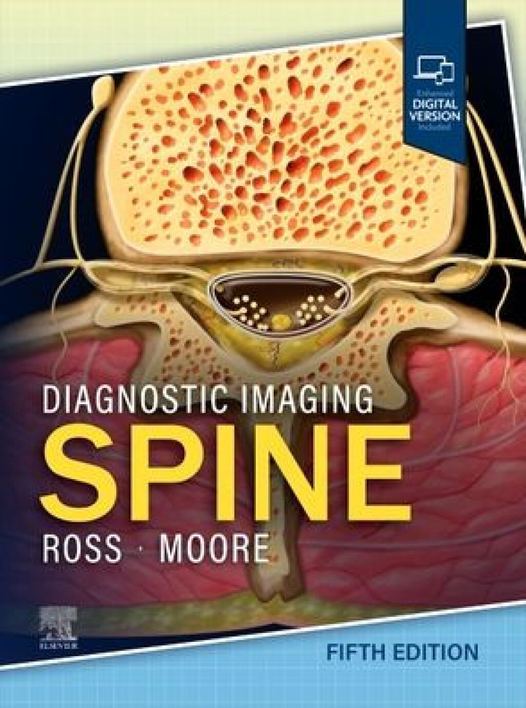 Diagnostic Imaging: Spine 5th Edition