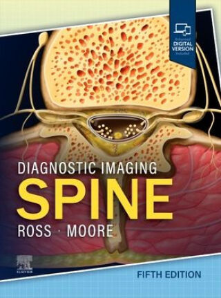 Cover image: Diagnostic Imaging: Spine 5th edition 9780443378812