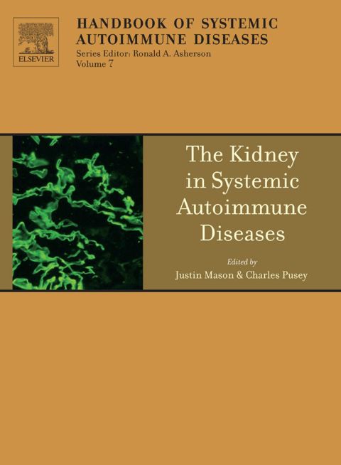 The Kidney in Systemic Autoimmune Diseases - FULL INSTANT DOWNLOAD | PDF DOCX EPUB