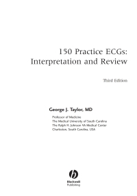 Cover image: 150 Practice ECGs: Interpretation and Review, 3rd Edition 1st edition 9781405104838