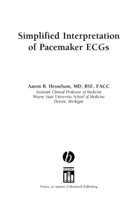 Imagen de portada: Simplified Interpretation of Pacemaker ECGs 1st edition 9781405103725