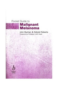 Cover image: Pocket Guide to Malignant Melanoma 1st edition 9780632054213