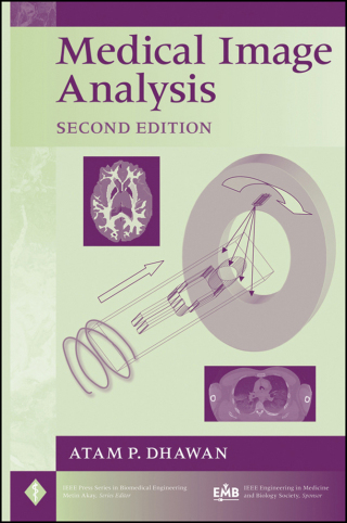 Imagen de portada: Medical Image Analysis 2nd edition 9780470622056