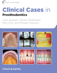 Cover image: Clinical Cases in Prosthodontics 1st edition 9780813816647