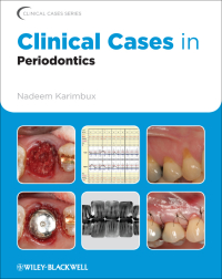 صورة الغلاف: Clinical Cases in Periodontics 1st edition 9780813807942