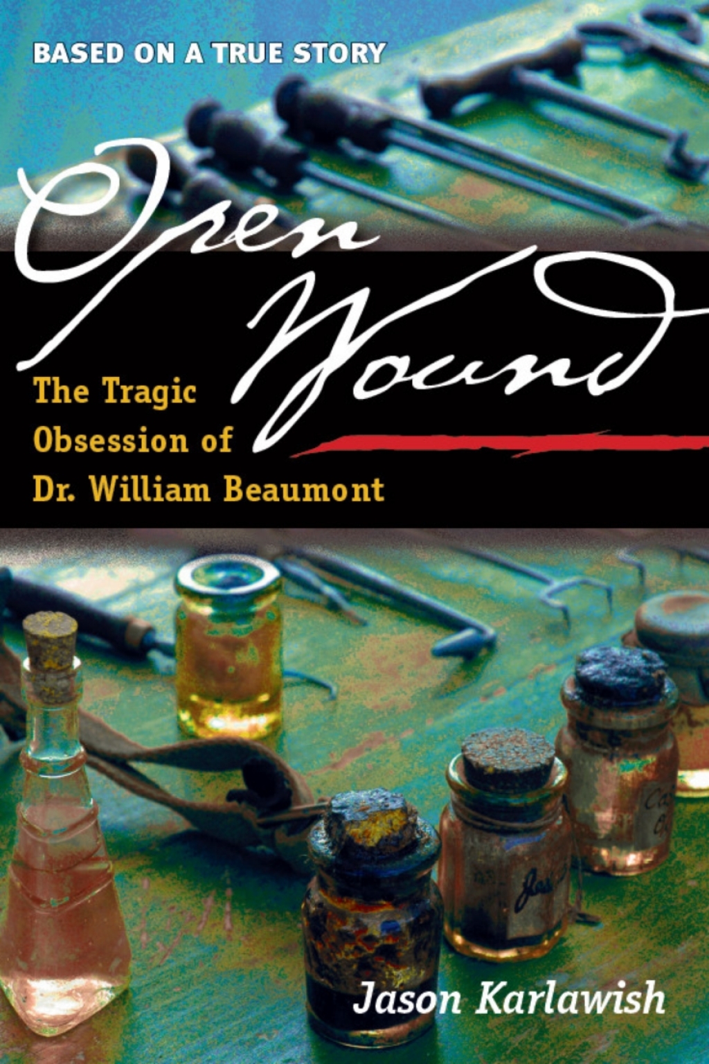Open Wound The Tragic Obsession of Dr. William Beaumont