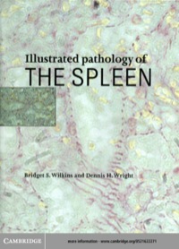 صورة الغلاف: Illustrated Pathology of the Spleen 1st edition 9780521622271