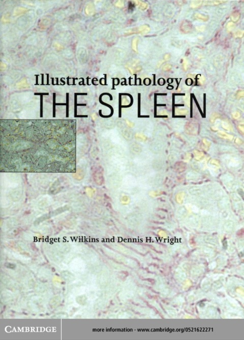 Illustrated Pathology of the Spleen, 1st Edition - FULL INSTANT DOWNLOAD | PDF DOCX EPUB