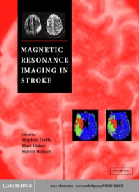 Cover image: Magnetic Resonance Imaging in Stroke 1st edition 9780521806831