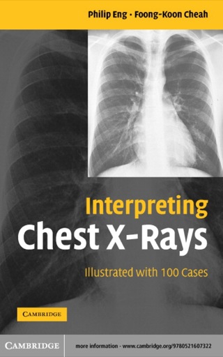Immagine di copertina: Interpreting Chest X-Rays 1st edition 9780521607322