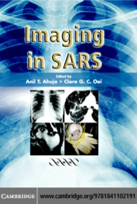 Cover image: Imaging in SARS 1st edition 9781841102191