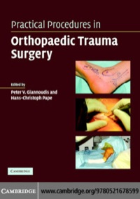 Imagen de portada: Practical Procedures in Orthopaedic Trauma Surgery 1st edition 9780521678599