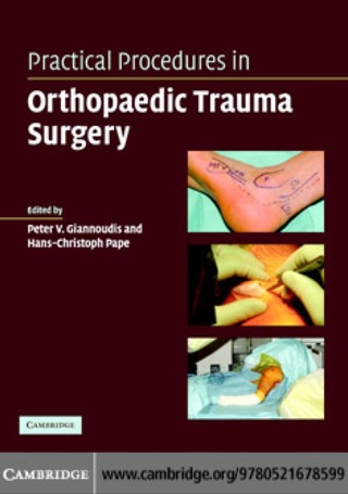 Cover image: Practical Procedures in Orthopaedic Trauma Surgery 1st edition 9780521678599