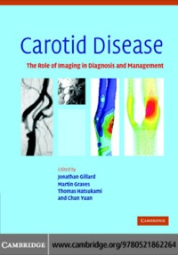 Imagen de portada: Carotid Disease 1st edition 9780521862264