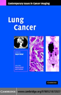 Cover image: Lung Cancer 1st edition 9780521872027