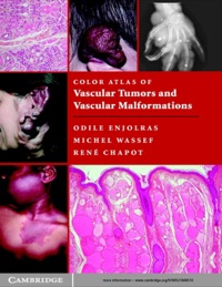 Cover image: Color Atlas of Vascular Tumors and Vascular Malformations 1st edition 9780521848510