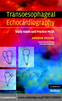 Cover image: Transoesophageal Echocardiography 1st edition 9780521689601