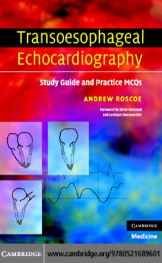 Transoesophageal Echocardiography 1st edition