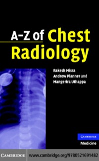 Cover image: A-Z of Chest Radiology 9780521691482