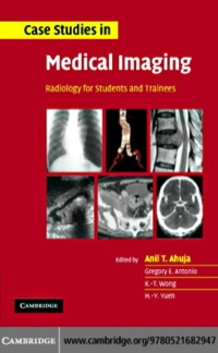 Cover image: Case Studies in Medical Imaging 1st edition 9780521682947