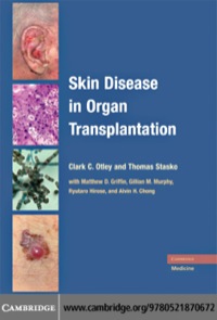 Titelbild: Skin Disease in Organ Transplantation 1st edition 9780521870672