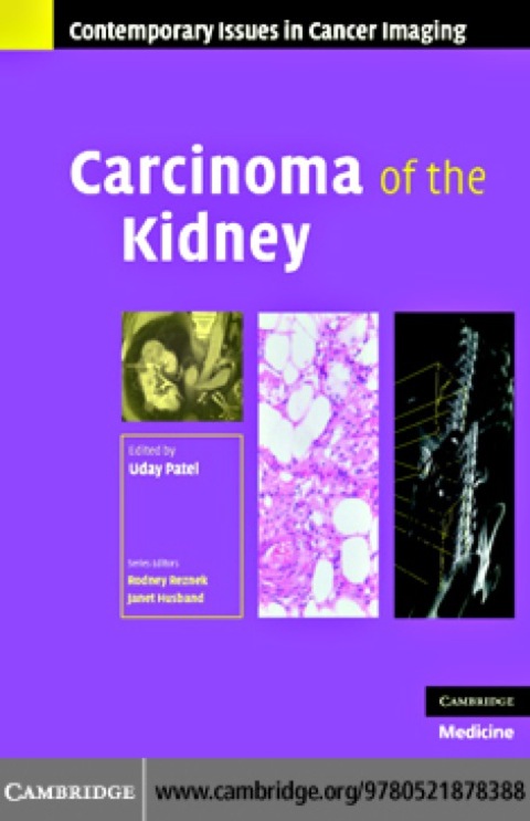 Carcinoma of the Kidney, 1st Edition - FULL INSTANT DOWNLOAD | PDF DOCX EPUB