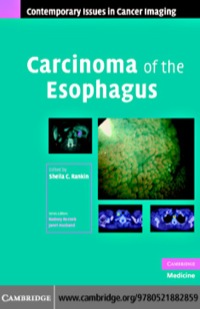 Titelbild: Carcinoma of the Esophagus 1st edition 9780521882859