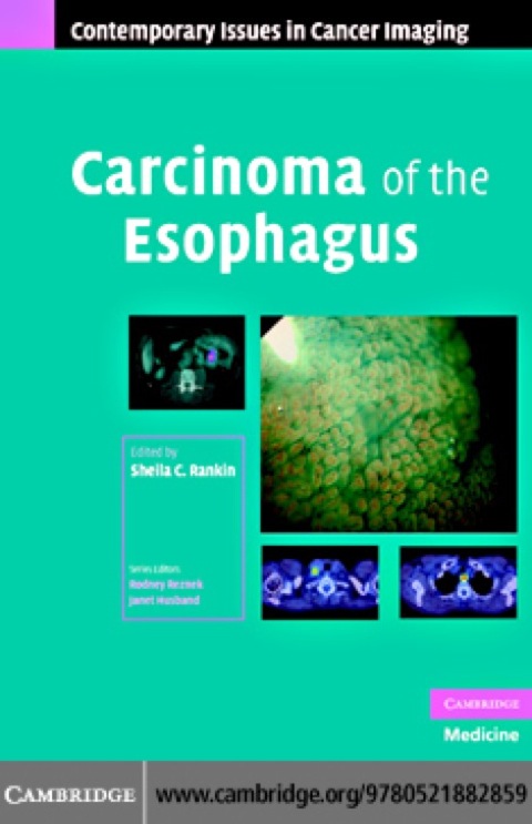 Carcinoma of the Esophagus, 1st Edition - FULL INSTANT DOWNLOAD | PDF DOCX EPUB