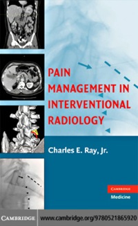 Imagen de portada: Pain Management in Interventional Radiology 1st edition 9780521865920