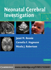 Cover image: Neonatal Cerebral Investigation 1st edition 9780521838481